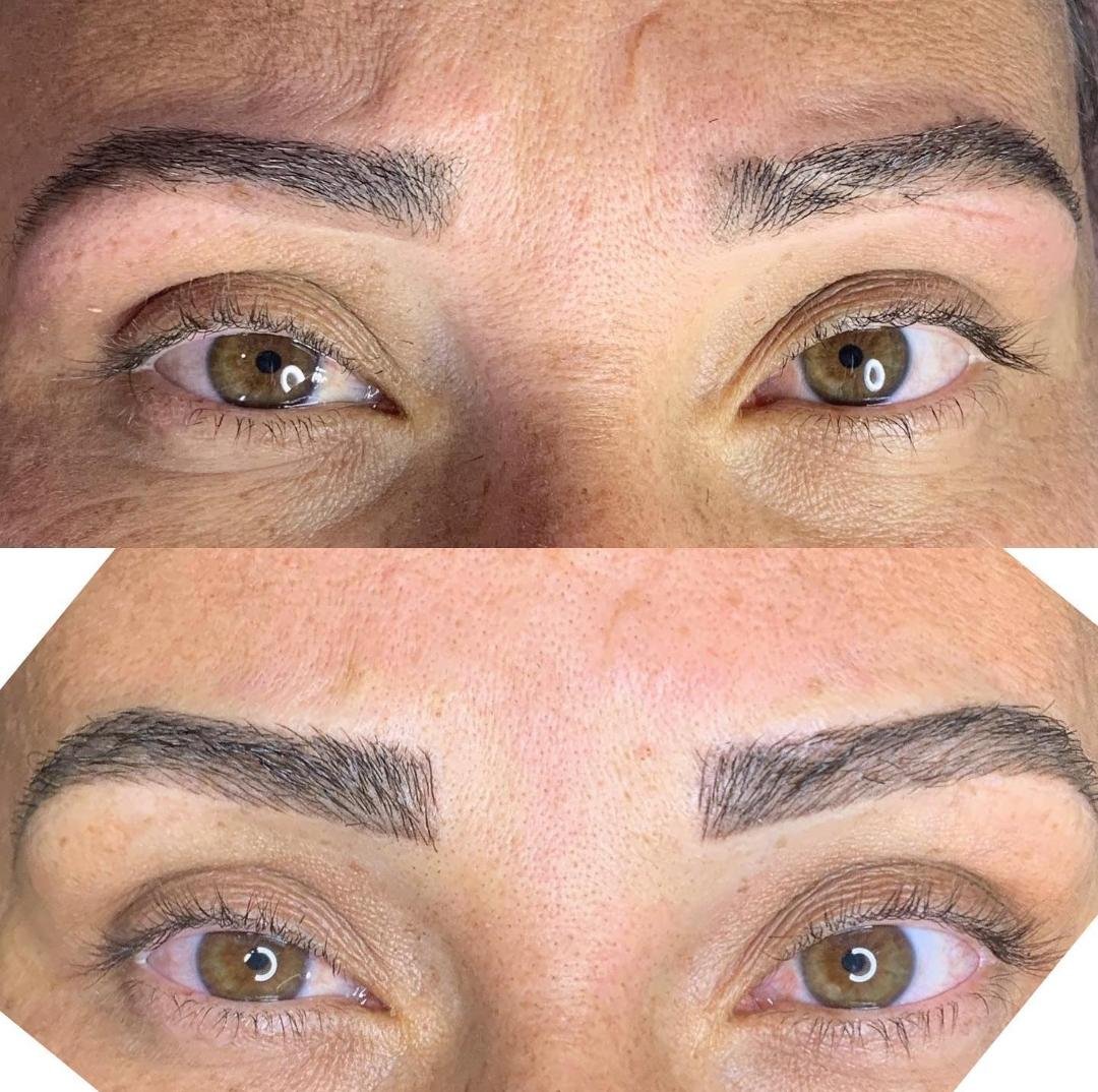 Antes e Depois Micropigmentação Elcilane Miranda
